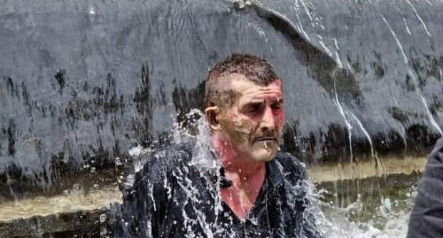 A man who injured himself during protest rally of LGBT opponents at the Parliament of Georgia. Photo: https://cnews.ge/home/news_description/36761/