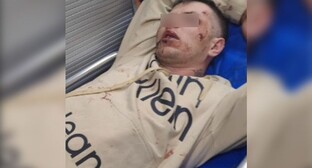 A veteran of the special military operation after being attacked in Rostov-on-Don. Screenshot of a video https://vk.com/wall-88393165_832042