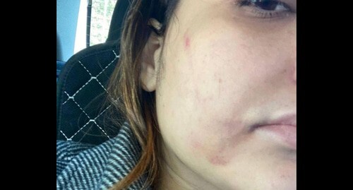 A female lawyer in Rostov-on-Don  after being attacked, photo: https://t.me/astrapress/62169